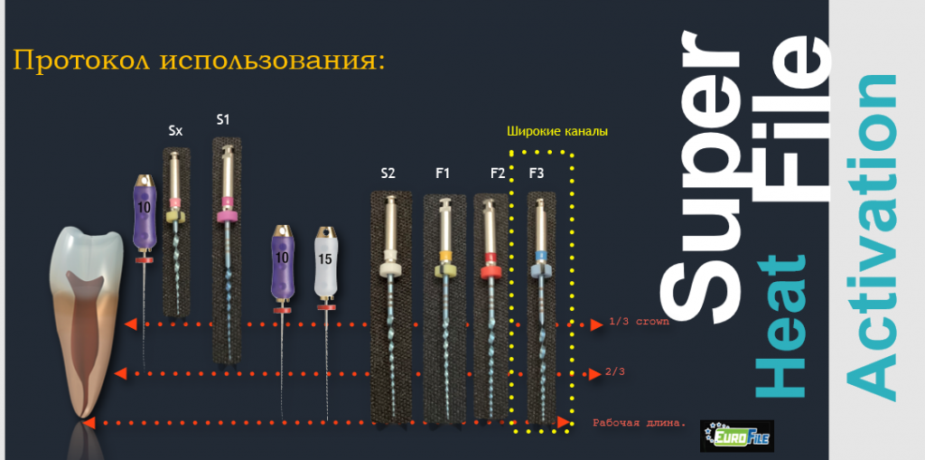 Протокол_Ultrataper_Superfile.png